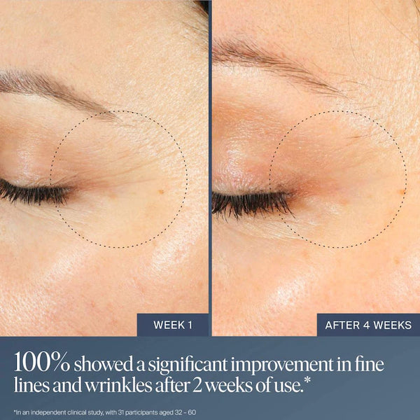 Preventa | Jet Lag Overnight Eye Serum for Fine Lines & Wrinkles with Gentle Retinol Blend