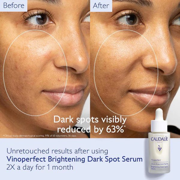 Preventa | Vinoperfect Brightening Routine for Dark Spots and Uneven Skin Tone