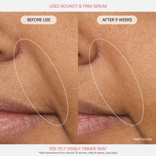 Preventa | Bouncy & Firm Radiance Boosting Serum with Peony & Collagen Complex™